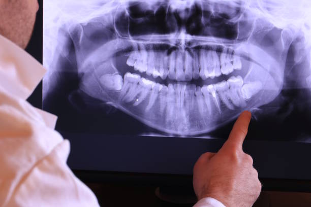 Best Emergency Dental Care for Broken or Chipped Teeth in Daniel, UT