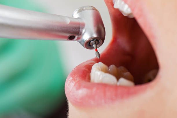 Best Cosmetic Emergency Dentistry in Daniel, UT